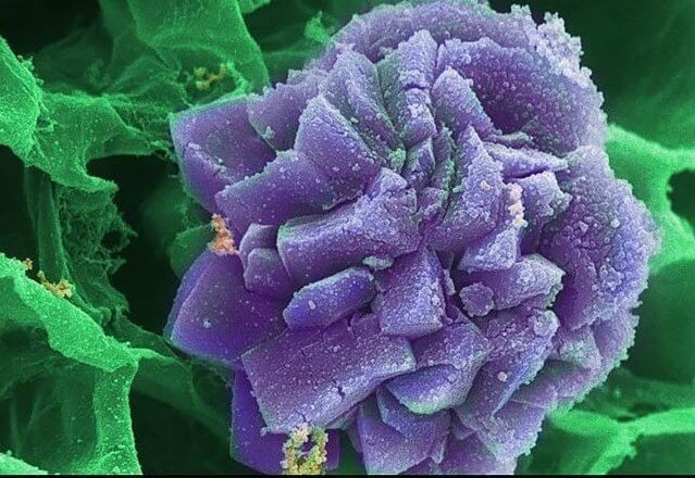 Оксалат кальция Кристалл оксалата кальция