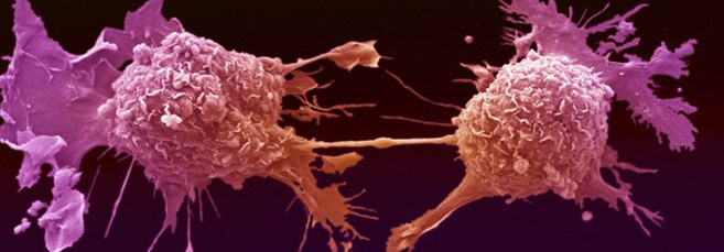 Алкоголь вызывает рак Алкоголь повышает вероятность возникновение рака